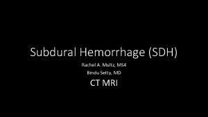 Subdural Hemorrhage SDH Rachel A Multz MS 4