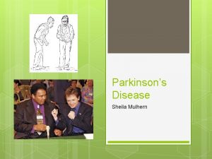 Parkinsons Disease Sheila Mulhern Parkinsons Disease Stats PDF