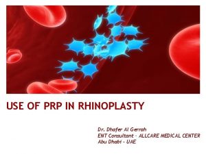 USE OF PRP IN RHINOPLASTY Dr Dhafer Al