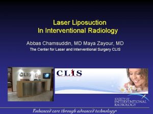 Laser Liposuction In Interventional Radiology Abbas Chamsuddin MD