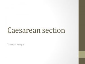 Caesarean section Tasneem Anagreh Definition A caesarean section