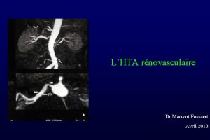 LHTA rnovasculaire Dr Marcant Fossaert Avril 2010 Physiopathologie