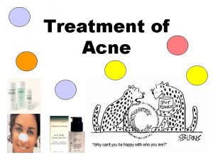 Acne conglobata popping