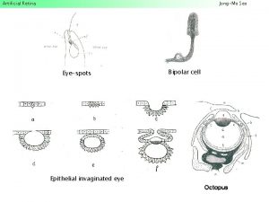 Artificial Retina JongMo Seo Eyespots Bipolar cell Epithelial