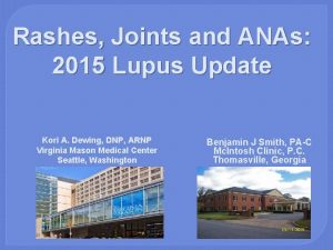 Rashes Joints and ANAs 2015 Lupus Update Kori