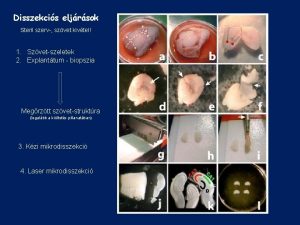 Disszekcis eljrsok Steril szerv szvet kivtel 1 Szvetszeletek