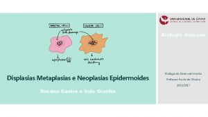 Biologia Humana Displasias Metaplasias e Neoplasias Epidermoides Biologia