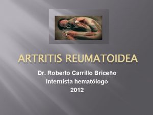 ARTRITIS REUMATOIDEA Dr Roberto Carrillo Briceo Internista hematlogo