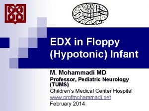 EDX in Floppy Hypotonic Infant M Mohammadi MD