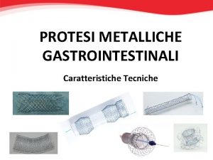 PROTESI METALLICHE GASTROINTESTINALI Caratteristiche Tecniche Protesi metalliche gastrointestinali
