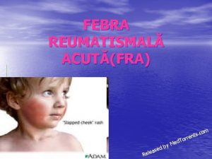 FEBRA REUMATISMAL ACUTFRA om c s nt ed