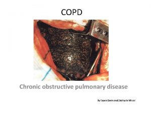 COPD Chronic obstructive pulmonary disease By Espen Gavin
