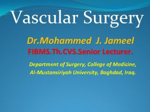 Vascular Surgery Dr Mohammed J Jameel FIBMS Th