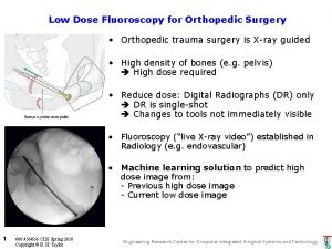 Low Dose Fluoroscopy for Orthopedic Surgery Orthopedic trauma