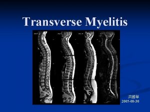 Transverse Myelitis 2005 08 30 Content Definition n