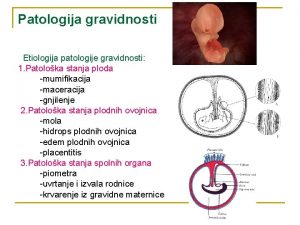 Patologija gravidnosti Etiologija patologije gravidnosti 1 Patoloka stanja