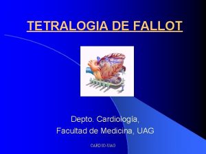 TETRALOGIA DE FALLOT Depto Cardiologa Facultad de Medicina