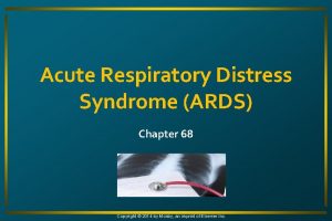 Acute Respiratory Distress Syndrome ARDS Chapter 68 Copyright