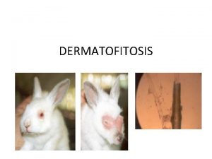 DERMATOFITOSIS DEFINICIN Enfermedad micotica asociada generalmente a un