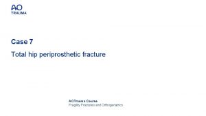 Case 7 Total hip periprosthetic fracture AOTrauma Course