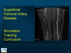 Superficial Femoral Artery Disease Simulation Training Curriculum 1