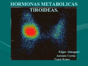 HORMONAS METABOLICAS TIROIDEAS Edgar Almaguer Antonio Cortez Tejon