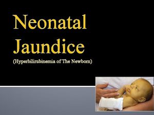 Neonatal Jaundice Hyperbilirubinemia of The Newborn Objectives By