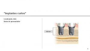 Implantes curtos Localizao data Nome do apresentador 6