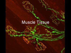 Muscle Tissue Muscle Tissue Outline General Functions of