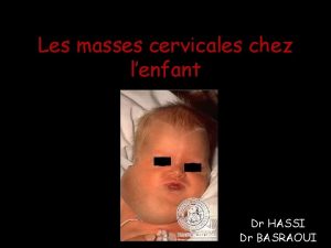 Les masses cervicales chez lenfant Dr HASSI Dr