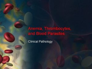 Anemia Thrombocytes and Blood Parasites Clinical Pathology Autoimmune