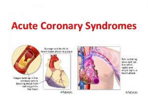 Acute Coronary Syndromes Table of Contents Introduction Management