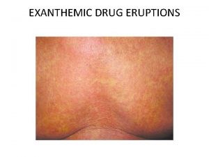 EXANTHEMIC DRUG ERUPTIONS The epidermis has necrotic keratinocytes