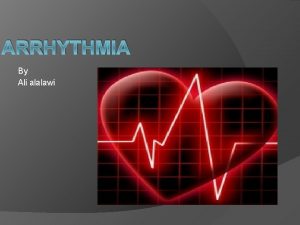 ARRHYTHMIA By Ali alalawi Arrhythmia Cardiac arrhythmia also