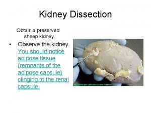 Kidney Dissection Obtain a preserved sheep kidney Observe