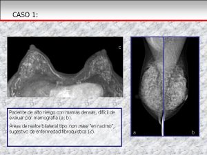CASO 1 c Paciente de alto riesgo con