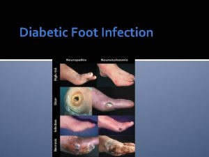 Diabetic Foot Infection Of all the late complications