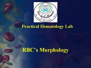 Practical Hematology Lab RBCs Morphology RBCS Abnormal Morphology