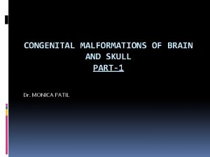 CONGENITAL MALFORMATIONS OF BRAIN AND SKULL PART1 Dr