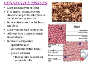 Most abundant type of tissue in the body