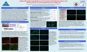 Collagen XVIIspecific autoantibodies in sera from patients with