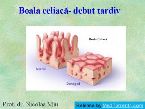 Boala celiac debut tardiv Prof dr Nicolae Miu