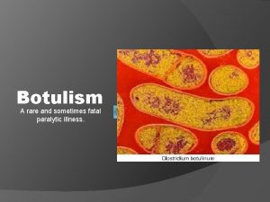 Botulism A rare and sometimes fatal paralytic illness