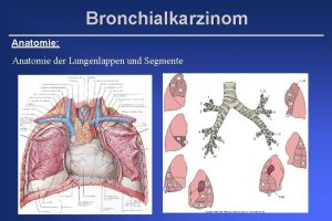 Bronchialkarzinom Anatomie Anatomie der Lungenlappen und Segmente Bronchialkarzinom