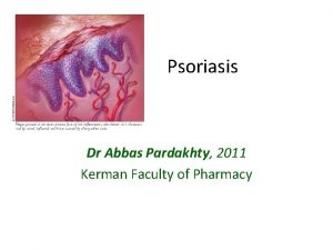 Psoriasis Dr Abbas Pardakhty 2011 Kerman Faculty of