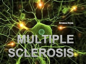 Breanna Bryan Multiple Sclerosis Definition Multiple Sclerosis is