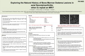 Exploring the Natural History of Bone Marrow Oedema