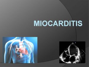 MIOCARDITIS DEFINICION Proceso inflamatorio del corazn que compromete