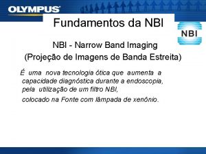 Fundamentos da NBI Narrow Band Imaging Projeo de