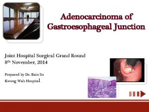 Adenocarcinoma of Gastroesophageal Junction Joint Hospital Surgical Grand